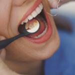 Hygienist checking for plaque on the back molars.